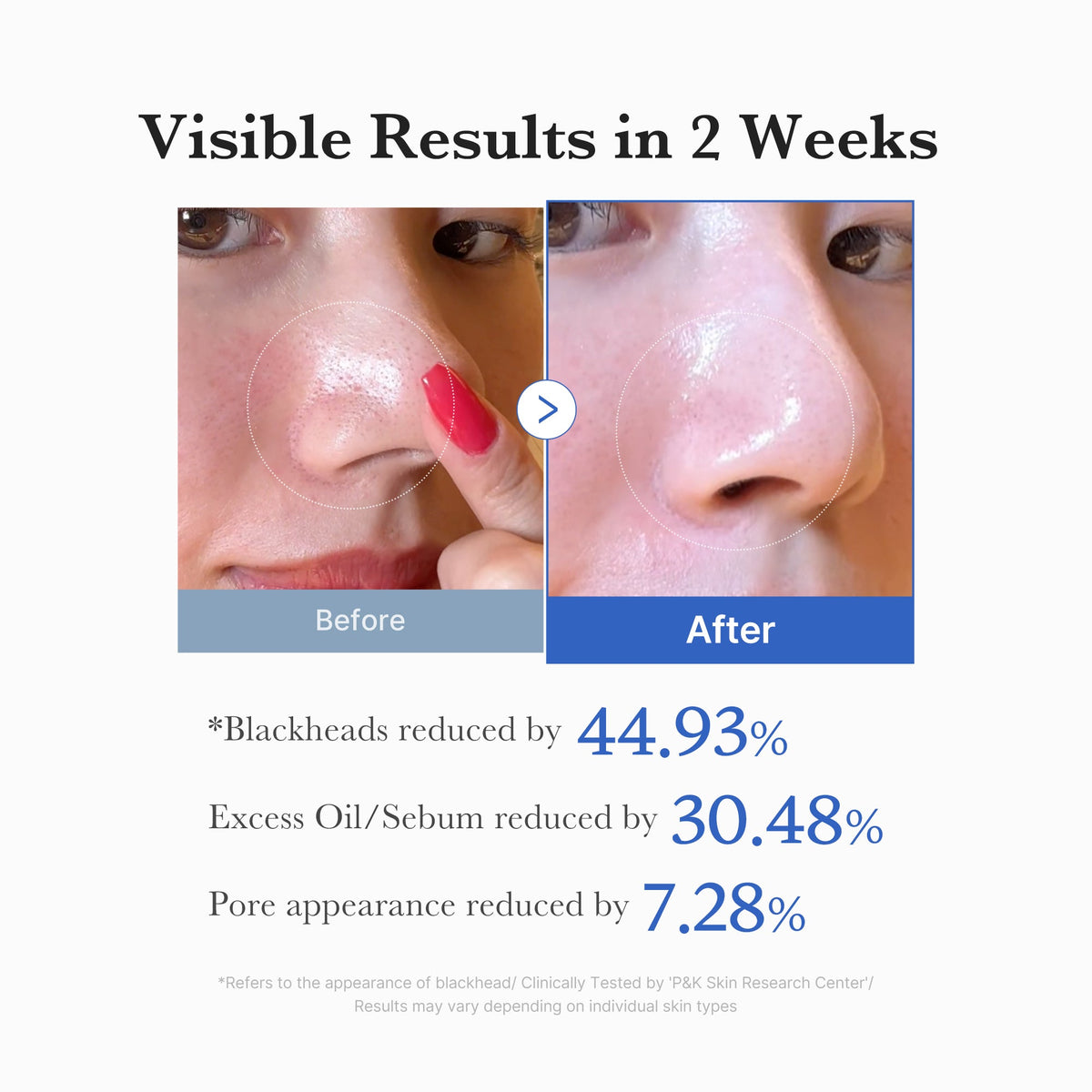 Zero Pore Pads SHOPIFY_ME