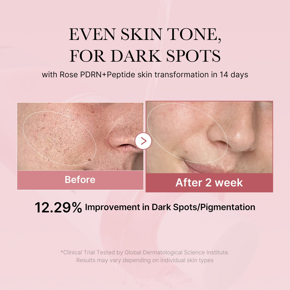PDRN Pink Peptide Toner SHOPIFY_ME